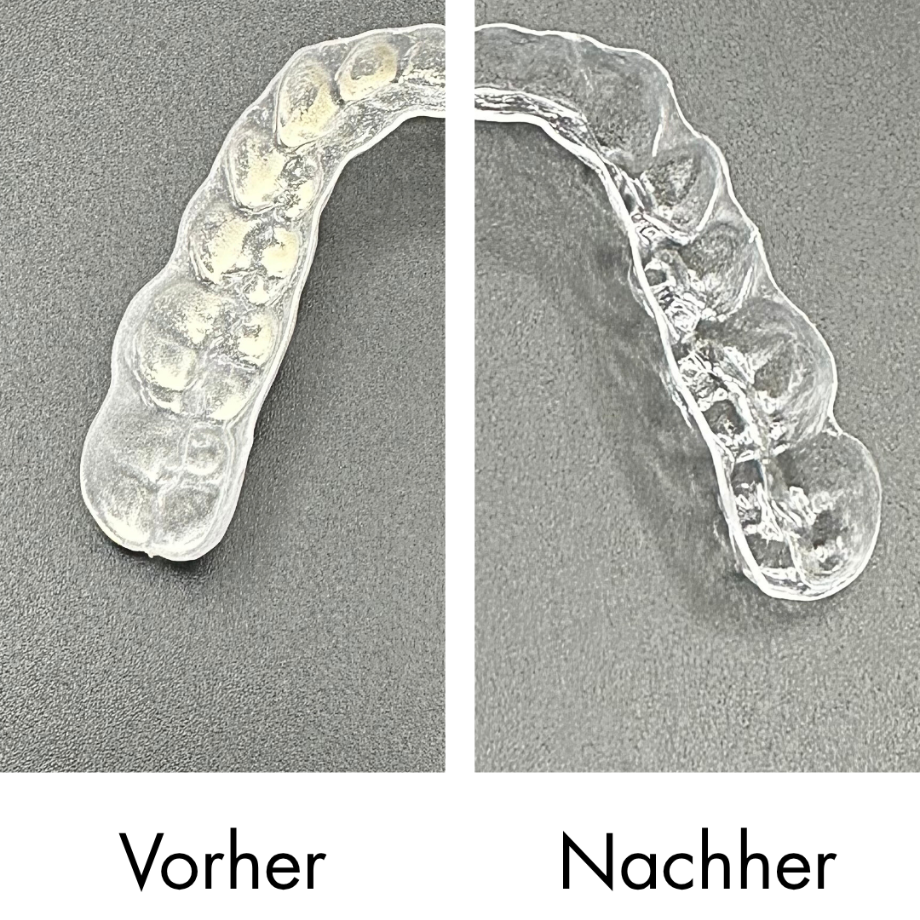 Ultraschallreiniger für Aligner & Zahnschienen